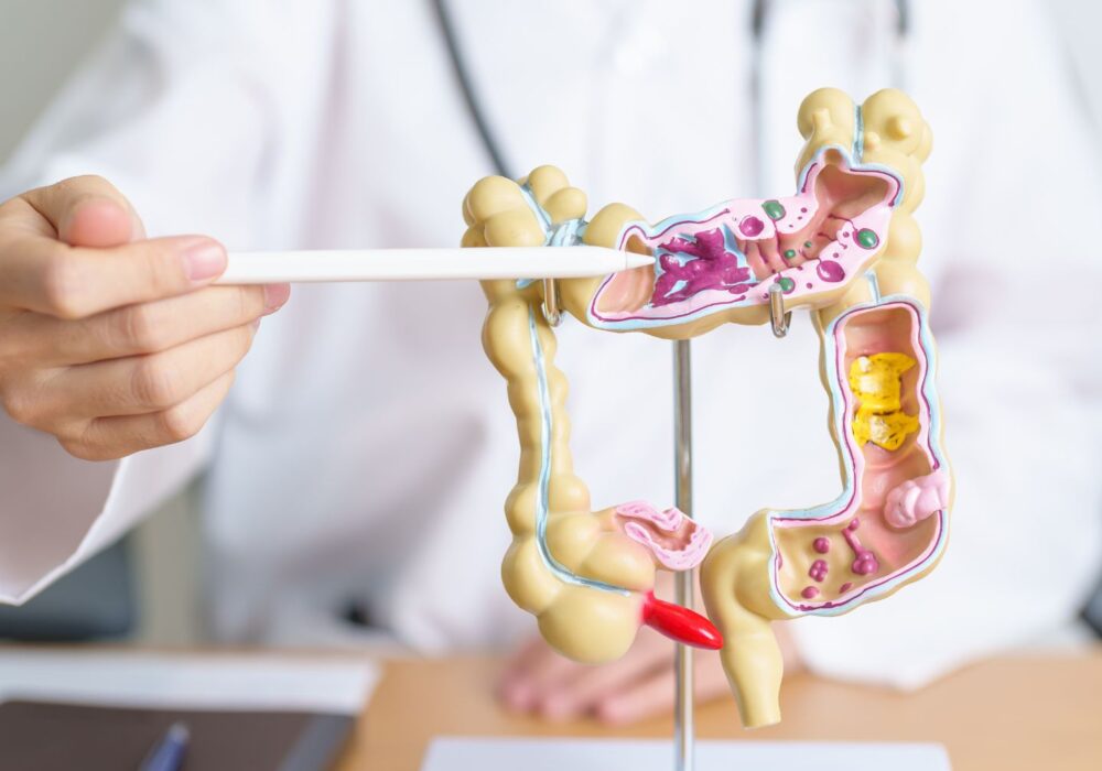 Darmsanierung & Mikrobiomtherapie für Saarlouis & das Saarland
